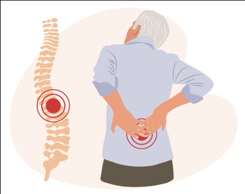 Soulager les douleurs liées à l’arthrose et à l’arthrite